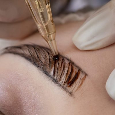 Microblanding en Majadahonda